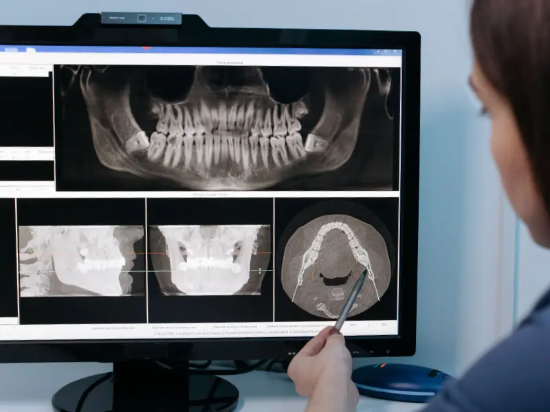 Dentist reviewing a panoramic dental X-ray on screen